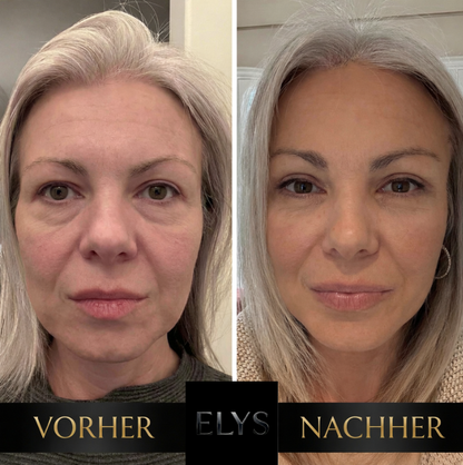 ELYS Sofort Augenlifting Creme